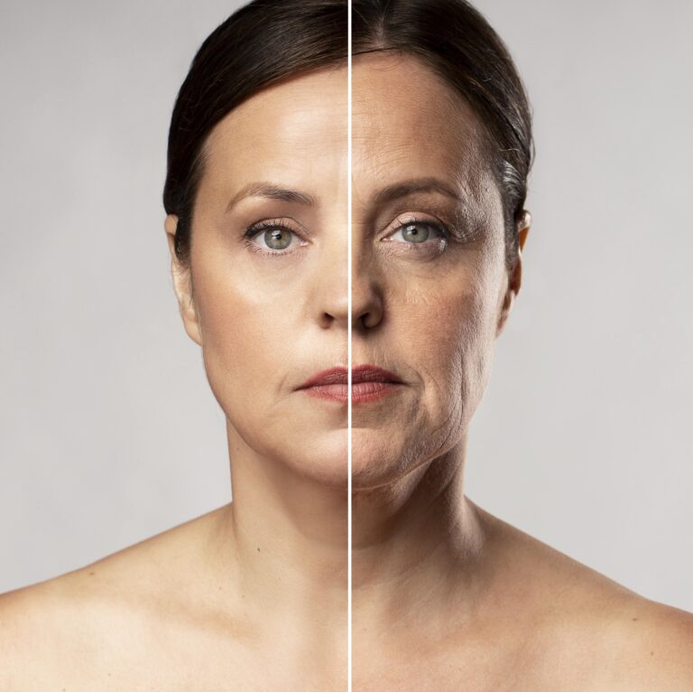 Microneedling