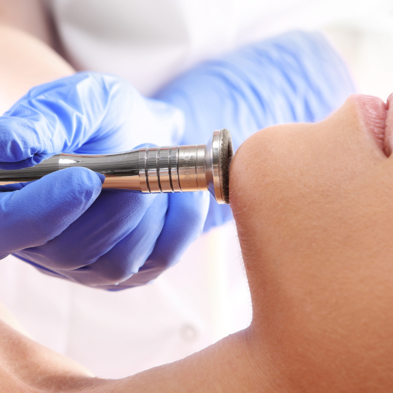 Dermabrasion diamantpeeling