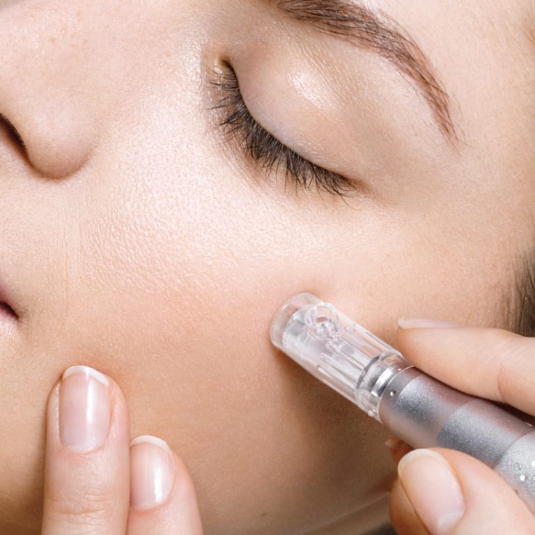 Microneedling med Clinicpen